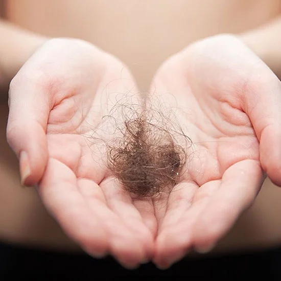 Hair loss from pattern baldness in both male and female patients